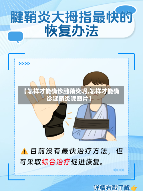 【怎样才能确诊腱鞘炎呢,怎样才能确诊腱鞘炎呢图片】-第2张图片