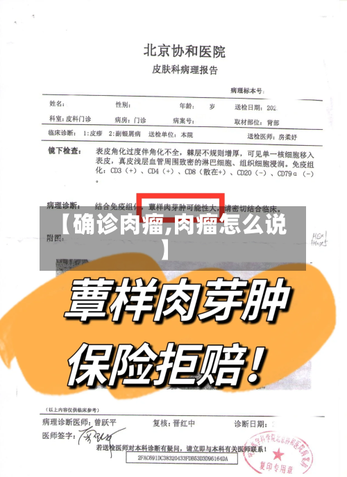 【确诊肉瘤,肉瘤怎么说】-第3张图片